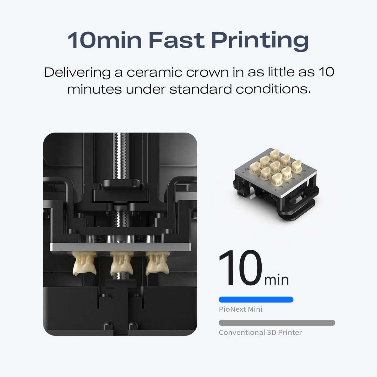 Miniaturowa, precyzyjna drukar – 3D Printing Orthodontics recenzja i cena